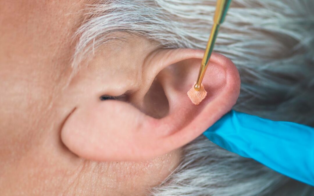 Definition-et-bienfaits-de-l auriculotherapie